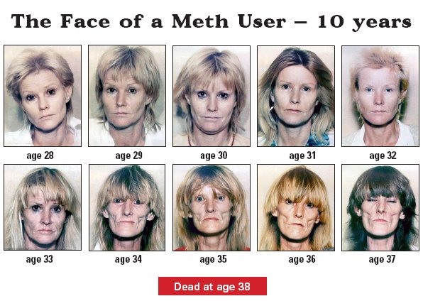Name:  picture-of-meth-addict.jpg
Views: 1106
Size:  64.8 KB